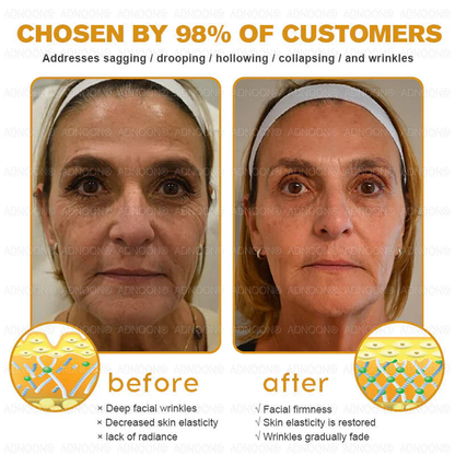 Official store✅ ADNOON® Botox Skin Care Spray, anti-aging, moisturizing, skin repair, even skin tone, acne and dark spots treatment, wart and mole removal, psoriasis relief (ACD certified)✨