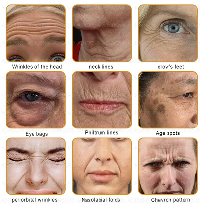 Official store✅ ADNOON® Botox Skin Care Spray, anti-aging, moisturizing, skin repair, even skin tone, acne and dark spots treatment, wart and mole removal, psoriasis relief (ACD certified)✨